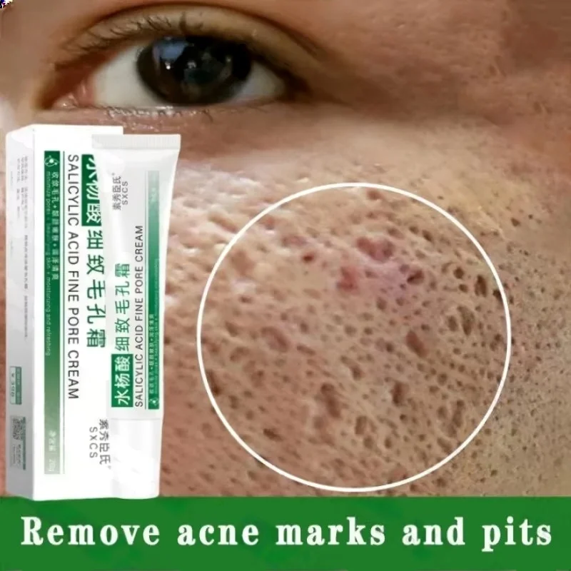 Skincare Salicylic Acid - 살리실산 모공 클리어링 크림 모공 축소