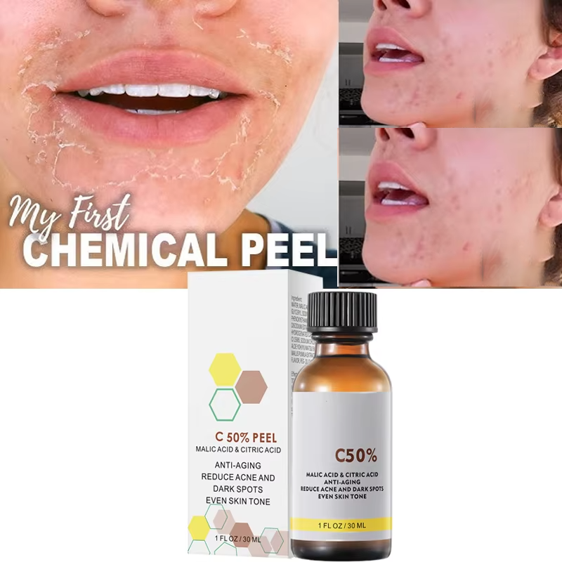 Skincare Salicylic Acid - 사과산과 구연산 함유 40% 필링 세럼,