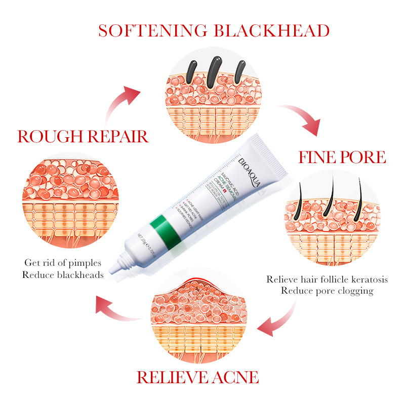 1/2/3pcs BIOAQUA 살리실산 페이스 크림 여 - Skincare Salicylic Acid 리뷰 및 가격
