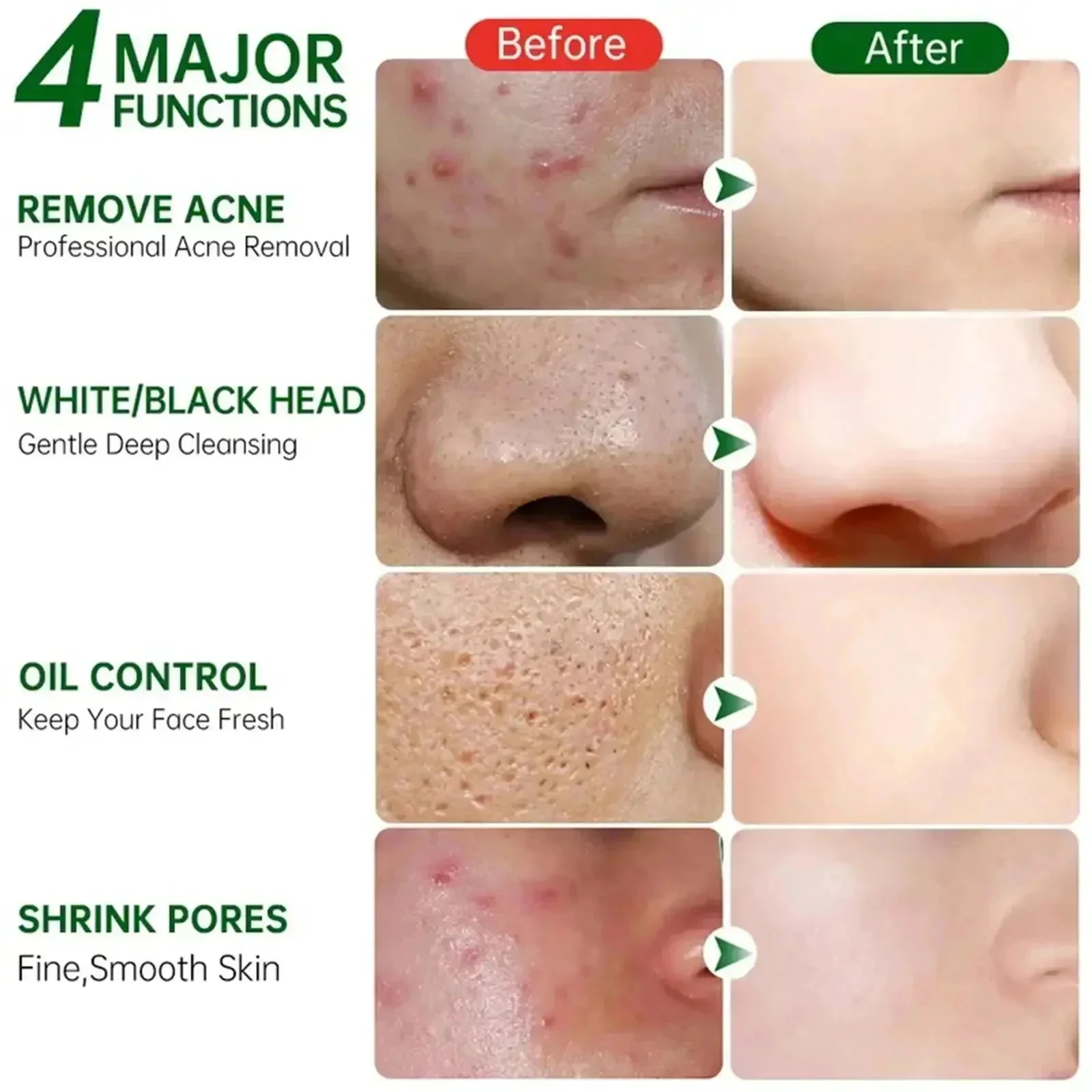 살리실산 모공 클리어링 크림 모공 축소 블랙헤드 제거  - Skincare Salicylic Acid 리뷰 및 가격