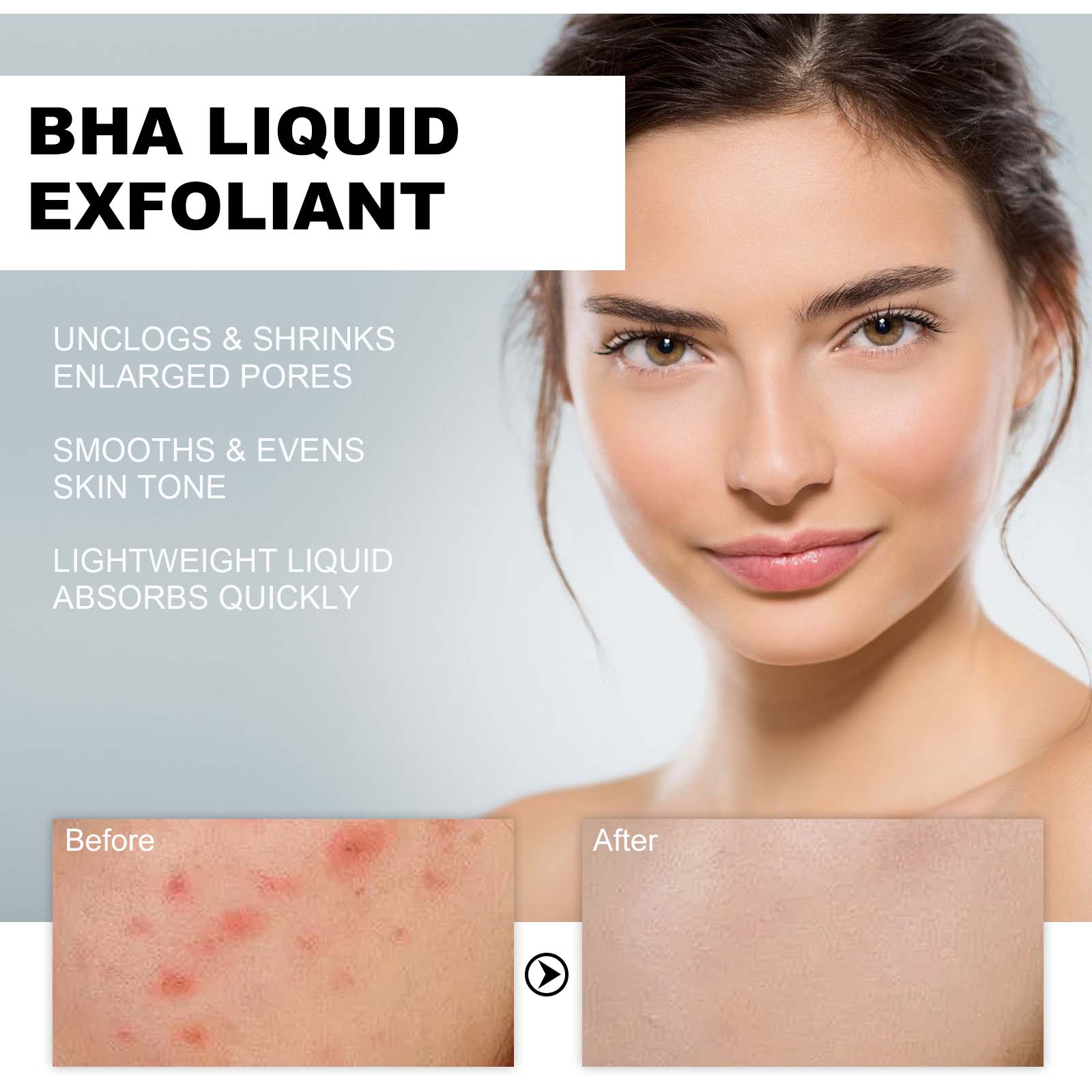 2% 살리실산 액상 각질 제거제 모공 축소 세럼, 확대 - Skincare Salicylic Acid 리뷰 및 가격