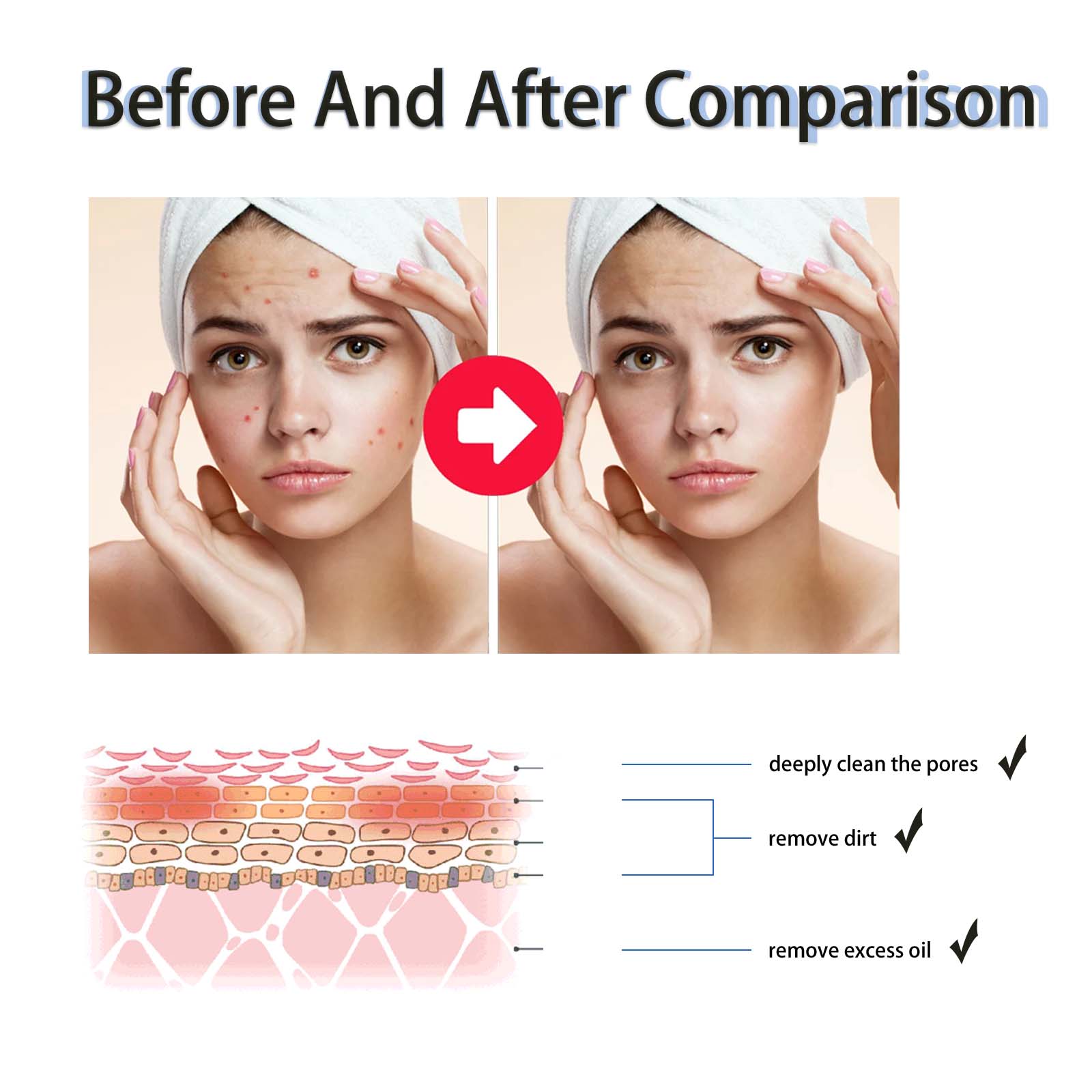 2% 살리실산 액상 각질 제거제 모공 축소 세럼, 확대 - Skincare Salicylic Acid 리뷰 및 가격