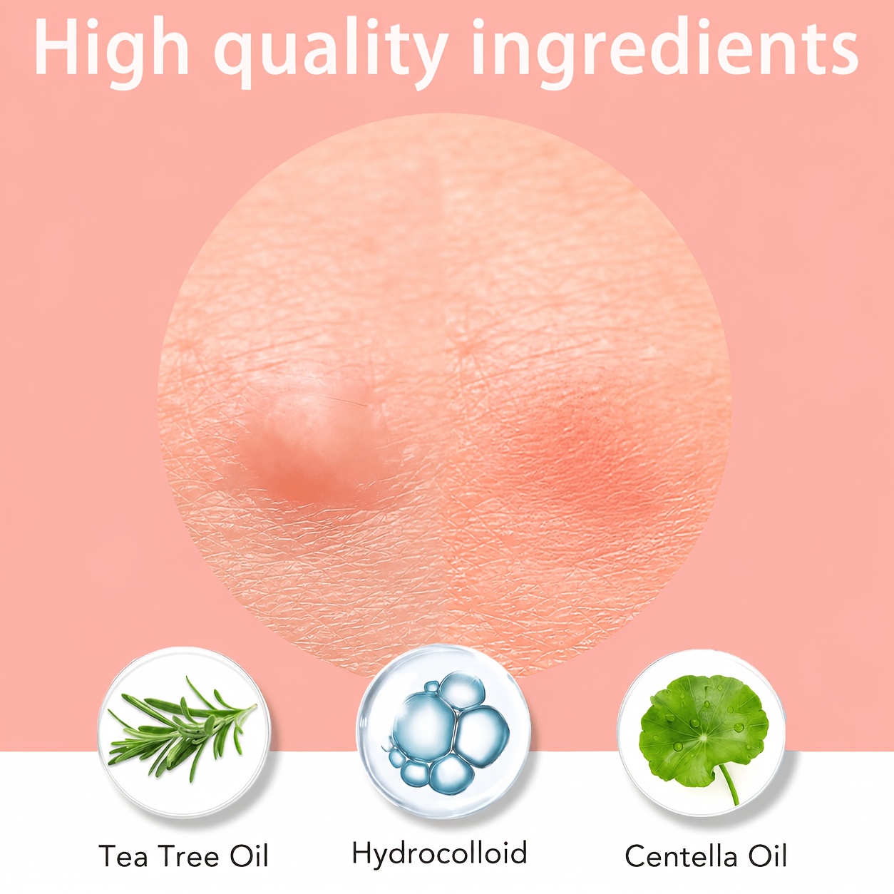 1200/400개입/박스 투명 여드름 패치 세트 - 딥 - Skincare Gentle 리뷰 및 가격