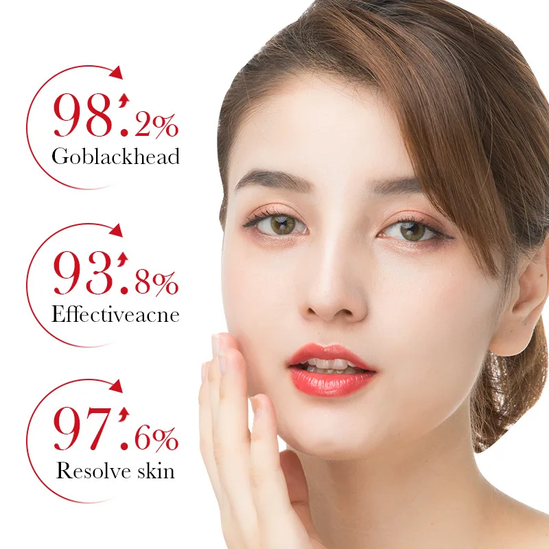 BIOAQUA 살리실산 여드름 제거 에센스 페이스 세럼 - Skincare Salicylic Acid 리뷰 및 가격