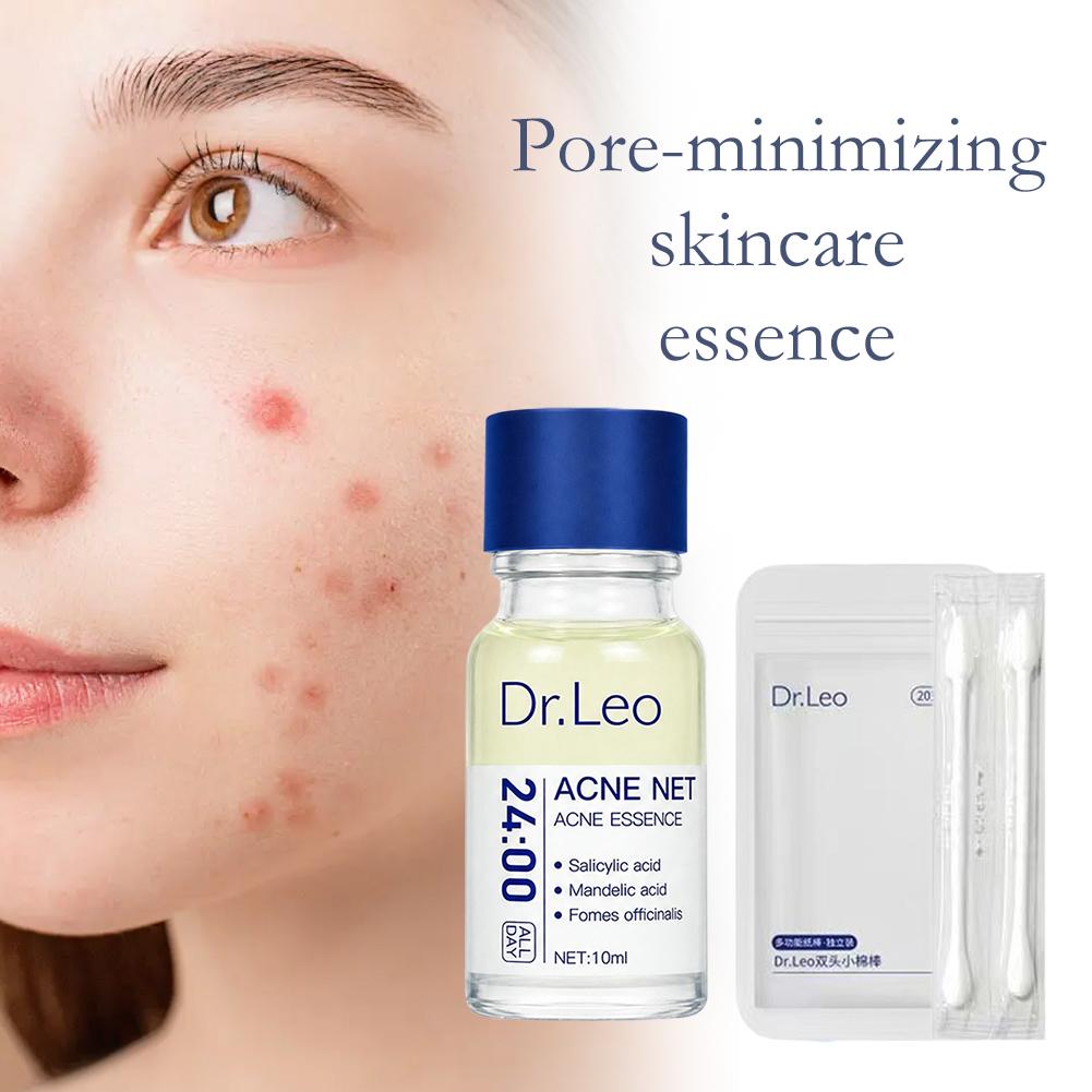 24시간 여드름 넷 스팟 에센스 10ml + 20개 듀 - Skincare Salicylic Acid 리뷰 및 가격